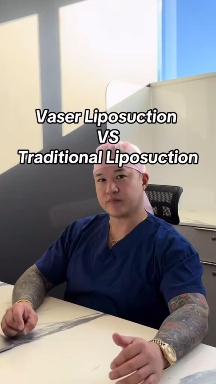 Vaser Liposuction vs Traditional Liposuction