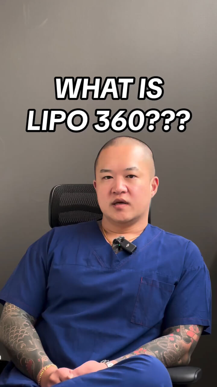 What is Lipo 360?